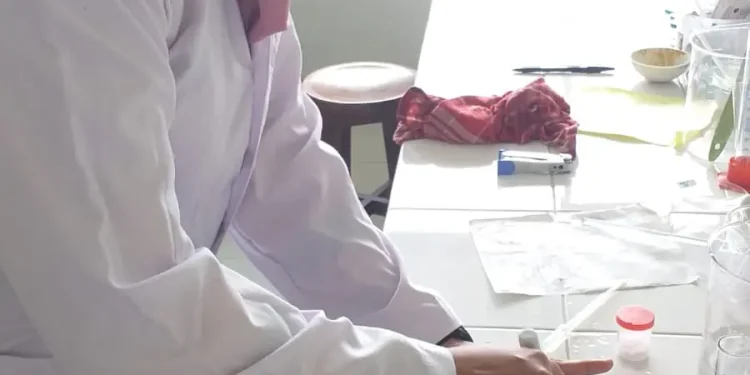 Mahasiswa FK UB temukan solusi kesehatan melalui penelitian berjudul Kacang Tunggak Sebagai Antioksidan Untuk Mencegah Osteoporosis. Foto: dok