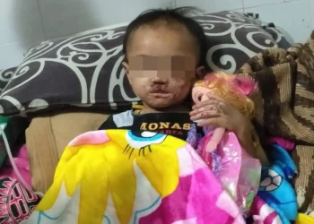 Balita N, saat dirawat di Rumah Sakit.