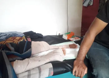 kaki anak patah tulang yang kaki ibunya diamputasi