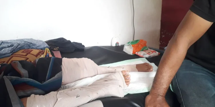 kaki anak patah tulang yang kaki ibunya diamputasi