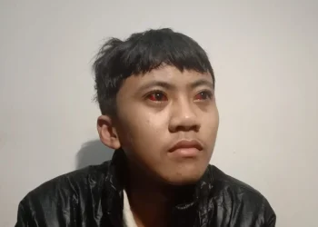 Kondisi mata merah Raffi Atha Dziaulhamdi yang tak kunjung sembuh usai terkena gas air mata dalam tragedi Kanjuruhan.