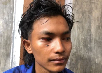 Lolos maut lewat lubang ventilasi Stadion kanjuruhan