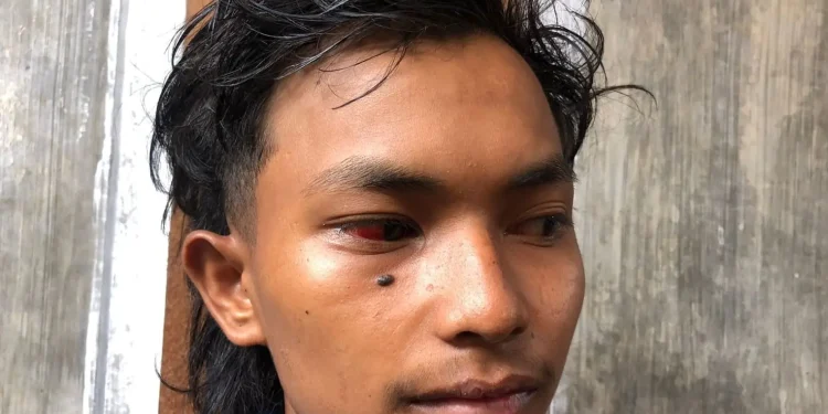 Lolos maut lewat lubang ventilasi Stadion kanjuruhan