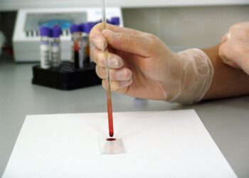 Ilustrasi sampel darah yang sedang diteliti.
