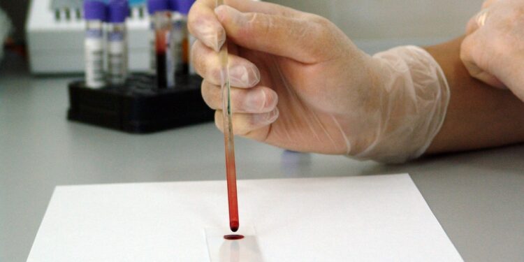 Ilustrasi sampel darah yang sedang diteliti.