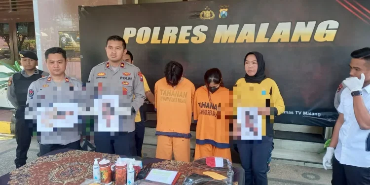 Polisi menunjukkan foto janin yang digugurkan oleh tersangka.