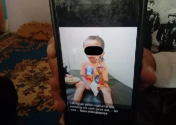 Potret bocah di Kota Malang yang menjadi korban penganiayaan sekeluarga.