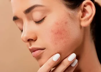 Ilustrasi penggunaan skincare yang gagal. Foto/Pinterest