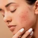 Ilustrasi penggunaan skincare yang gagal. Foto/Pinterest