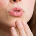 Ilustrasi bibir kering saat berpuasa dan cara mengatasinya. (Foto: Pinterest)