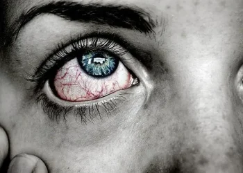Ilustrasi penyebab kerusakan mata. Foto/Pixabay