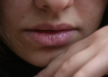 Ilustrasi kebiasaan buruk penyebab bibir menghitam. Foto/Pixabay