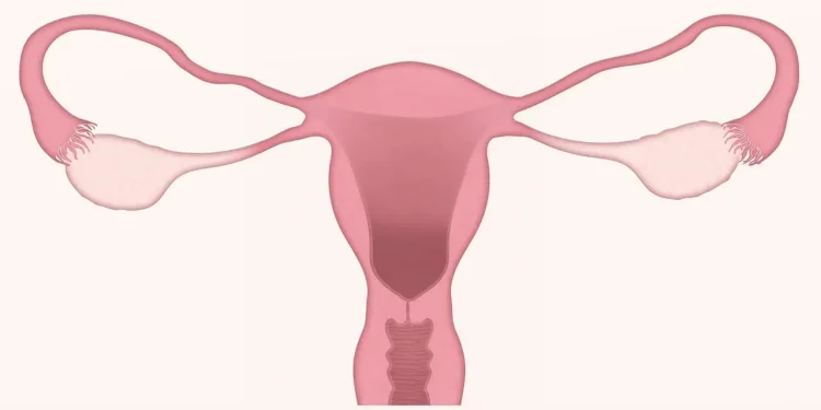Ilustrasi kanker serviks yang banyak diderita oleh banyak perempuan di seluruh dunia. Foto/Pixabay