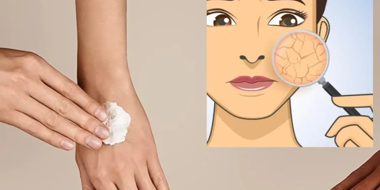 Pemakaian body lotion dan moisturizer untuk mencegah kulit kering di musim dingin. Foto/Pinterest
