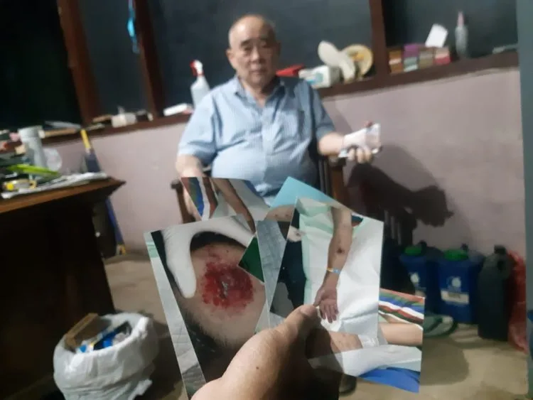 Foto bekas luka luka kakek di Kota Malang, Otje Suandito usai diduga mengalami penganiayaan oknum pengacara. (Foto/M Sholeh)