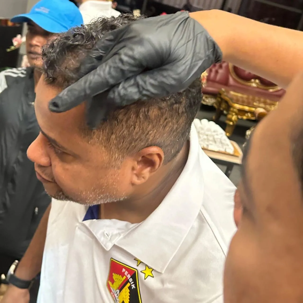 Pelatih Persik Kediri, Divaldo Alves terluka akibat insiden pelemparan batu bus. (Foto/ist)