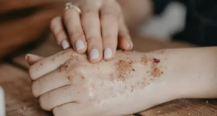 PHM ungkap masalah gatal setelah mandi bukan masalah salah sabun tapi karena kulit sensitif, produk herbal Sativa Cream jadi solusi. /Foto: Unsplash.com/Anita Austvika.