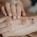 PHM ungkap masalah gatal setelah mandi bukan masalah salah sabun tapi karena kulit sensitif, produk herbal Sativa Cream jadi solusi. /Foto: Unsplash.com/Anita Austvika.