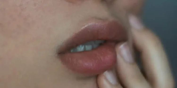 bibir pecah