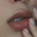 bibir pecah