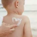 PHM beberkan manfaat produk herbal untuk mengatasi masalah kulit atopi. /Foto: Pinterest