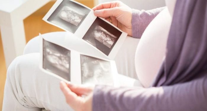 Hospital Penawar hadirkan paket pemeriksaan IUI dengan layanan kesehatan terbaik dan harga yang terjangkau. /Foto: Pinterest.