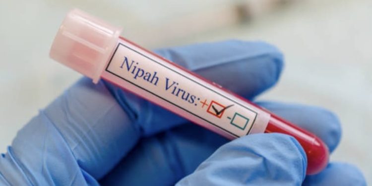 Virus Nipah