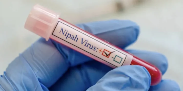 Virus Nipah