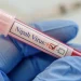 Virus Nipah
