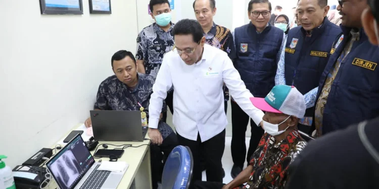 Kasus TBC di Kota Malang Turun, Pemkot Perkuat Kolaborasi Percepatan Eliminasi